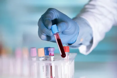 Биорезонансный неинвазивный анализ крови